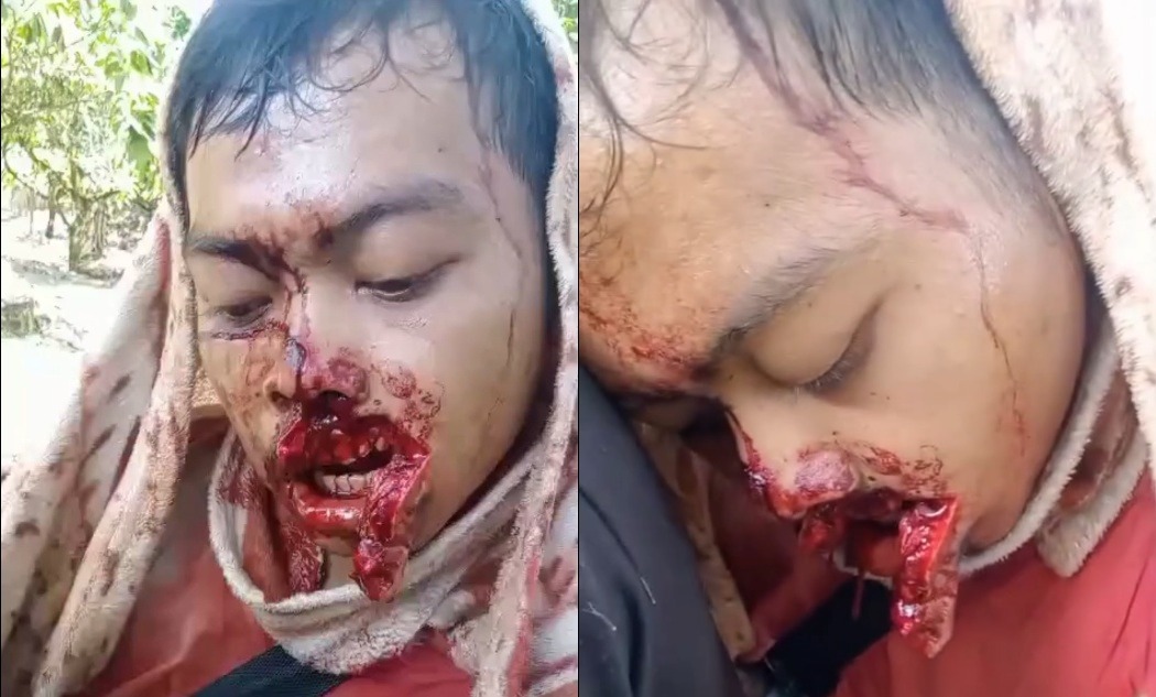 Vicious Sumatran Tiger Mauls 26-Year-Old Farmer in Aceh
