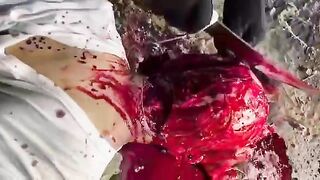 Classic: A guy gets flayed while being heavily sedated (The Zacatecas Flaying)
