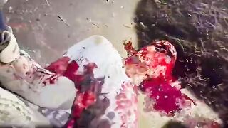 Classic: A guy gets flayed while being heavily sedated (The Zacatecas Flaying)
