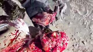 Classic: A guy gets flayed while being heavily sedated (The Zacatecas Flaying)