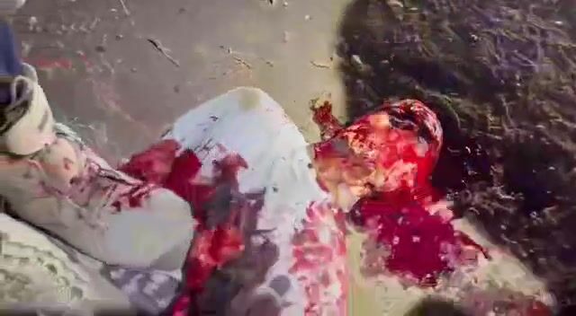 Classic: A guy gets flayed while being heavily sedated (The Zacatecas Flaying)