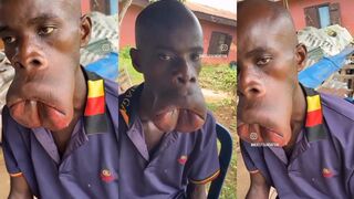 The bell mouth