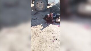 Aftermath Of The Knife Fight In  Espírito Santo