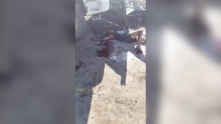 Aftermath Of The Knife Fight In  Espírito Santo