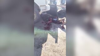 Aftermath Of The Knife Fight In  Espírito Santo