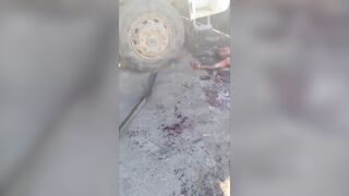 Aftermath Of The Knife Fight In  Espírito Santo