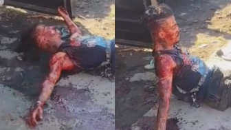 Aftermath Of The Knife Fight In  Espírito Santo