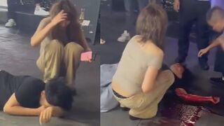 Dude Gets Kicked In The Head Over A Tourist Girl, Left Bleeding In Public