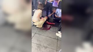 Dude Gets Kicked In The Head Over A Tourist Girl, Left Bleeding In Public