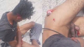 He Tried To Rape A Woman And Good Samaritans Ripped His Testicles Off