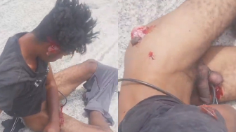 He Tried To Rape A Woman And Good Samaritans Ripped His Testicles Off
