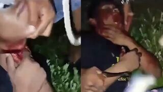 Gang Members Slit Competitor's Throat Then Stab His Face Multiple Times