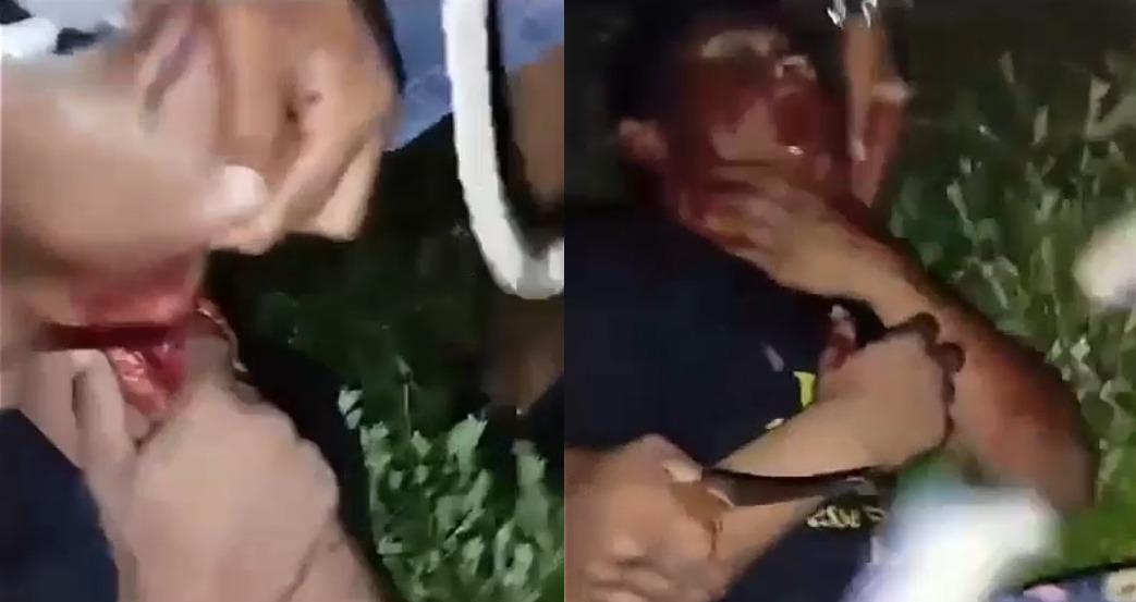 Gang Members Slit Competitor's Throat Then Stab His Face Multiple Times