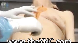 Medical Reference: Autopsy Of A Male