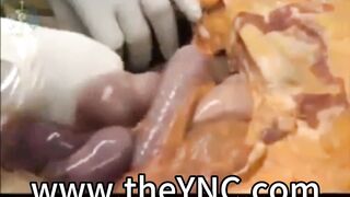 Medical Reference: Autopsy Of A Male