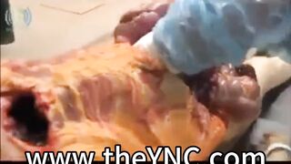 Medical Reference: Autopsy Of A Male