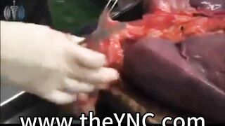 Medical Reference: Autopsy Of A Male