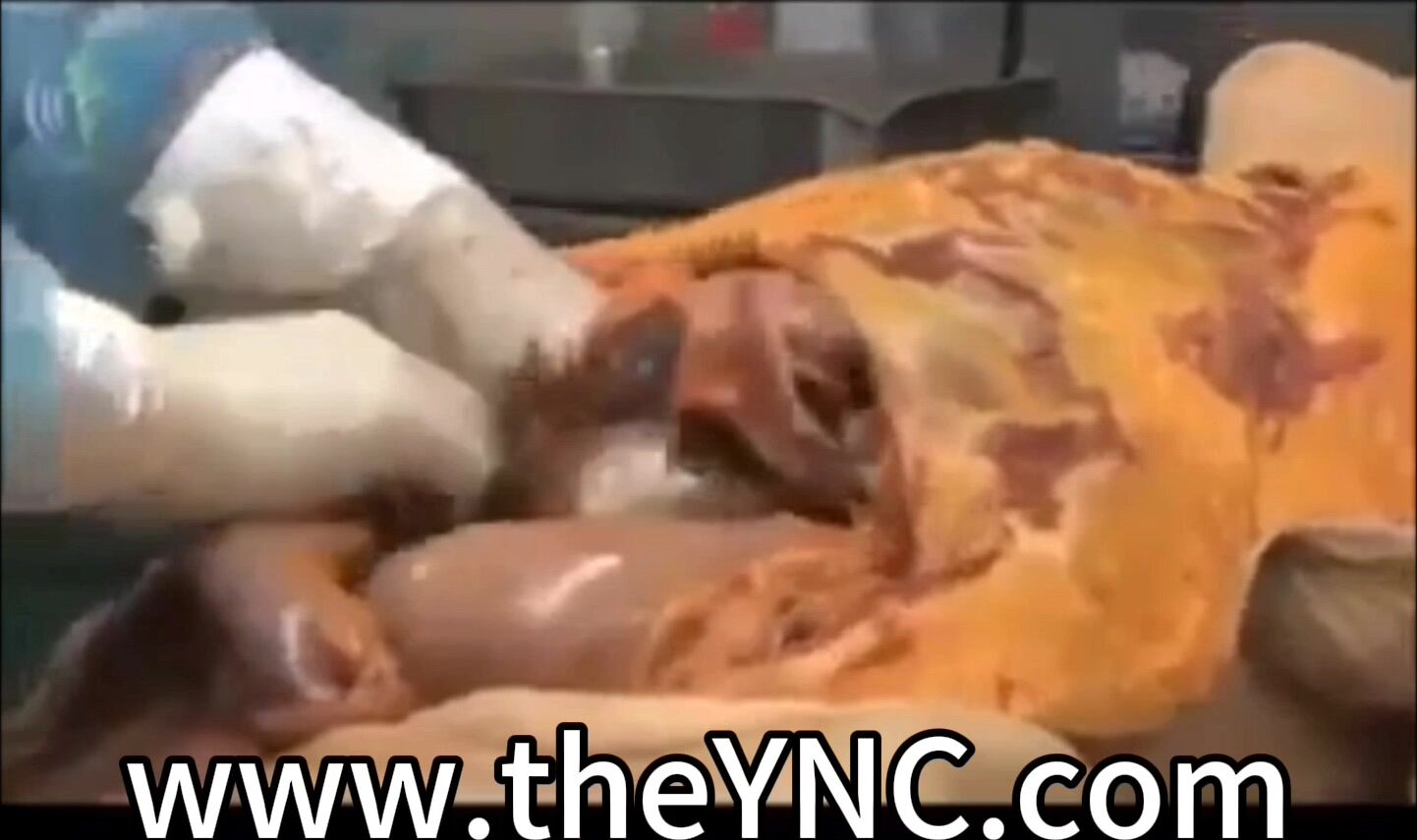 Medical Reference: Autopsy Of A Male