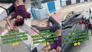 Accident splits mans head open