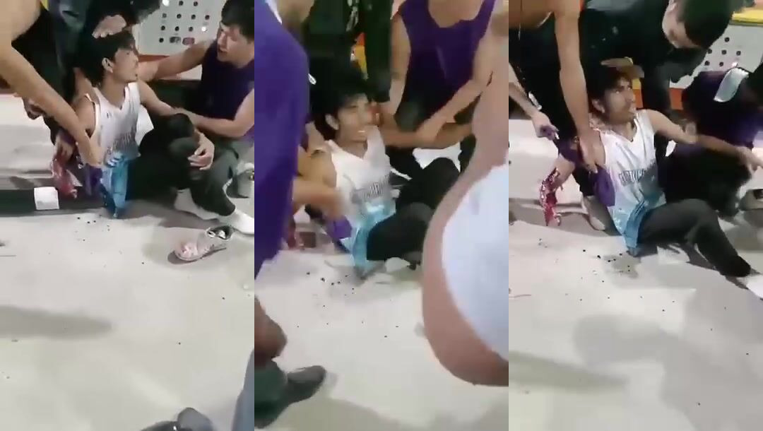 Conveyer rips mans arm off work accident