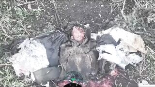 Severed Russian Has a Creepy 1000-Yard Stare