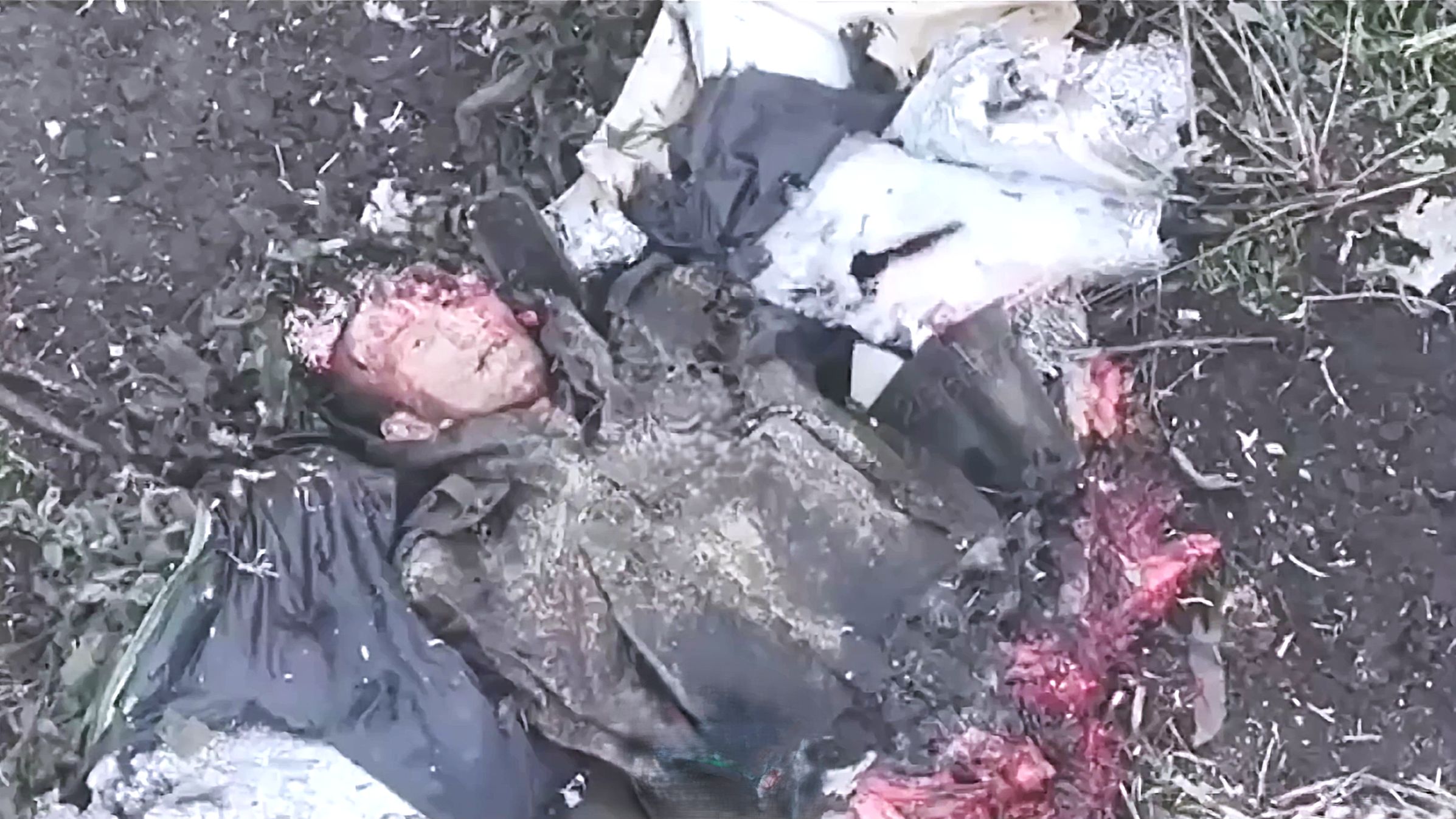 Severed Russian Has a Creepy 1000-Yard Stare