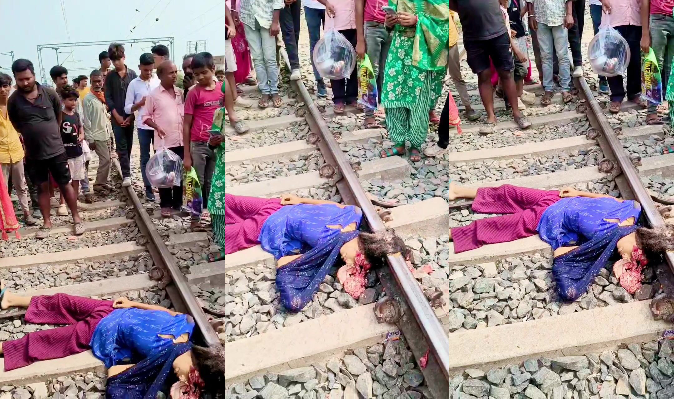 Womans head turned to mush after train accident