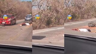 Man loses leg in motorbike accident