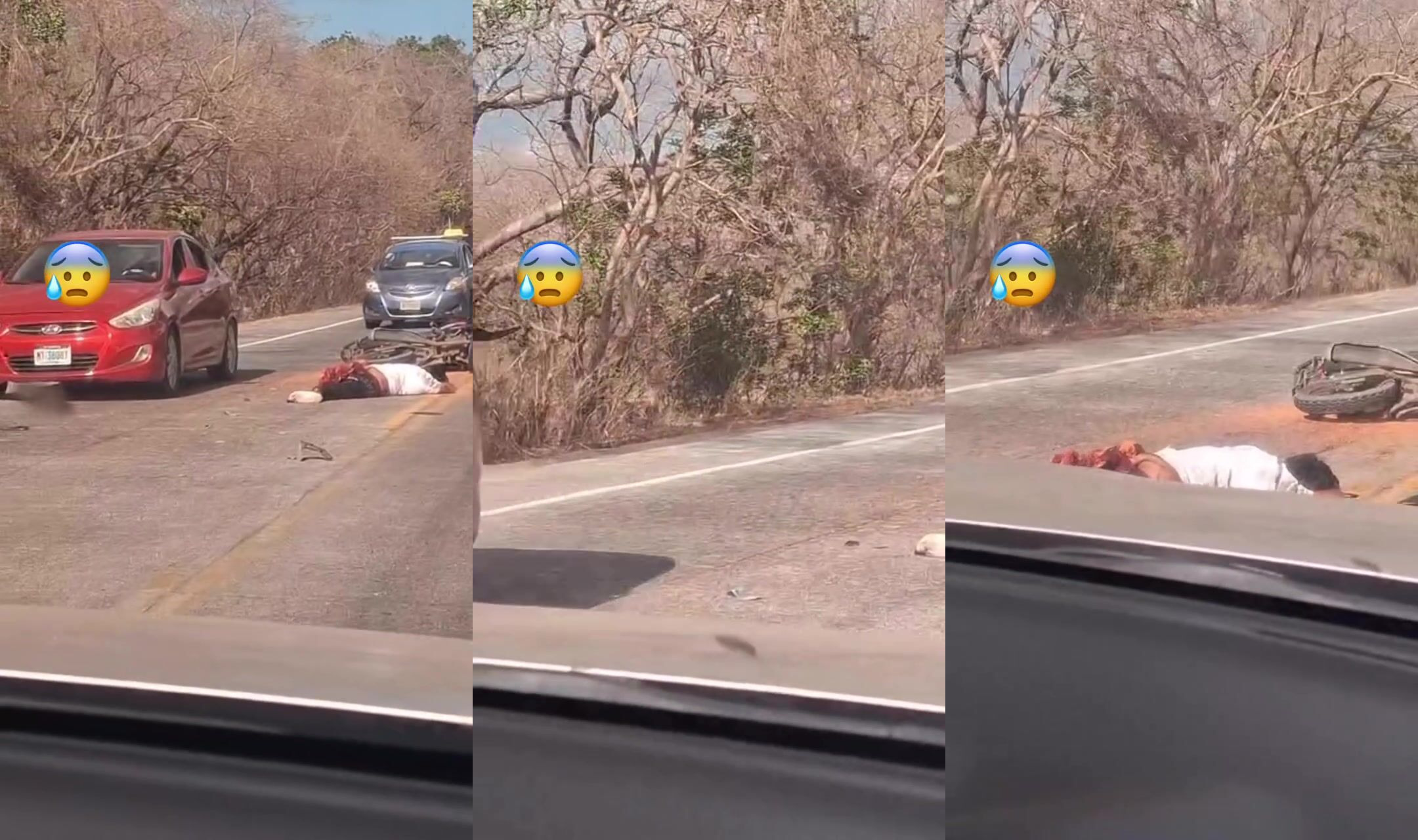 Man loses leg in motorbike accident