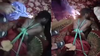 Man Brutally Beaten & Tortured with Melted Plastic by Heartless Human Smuggler