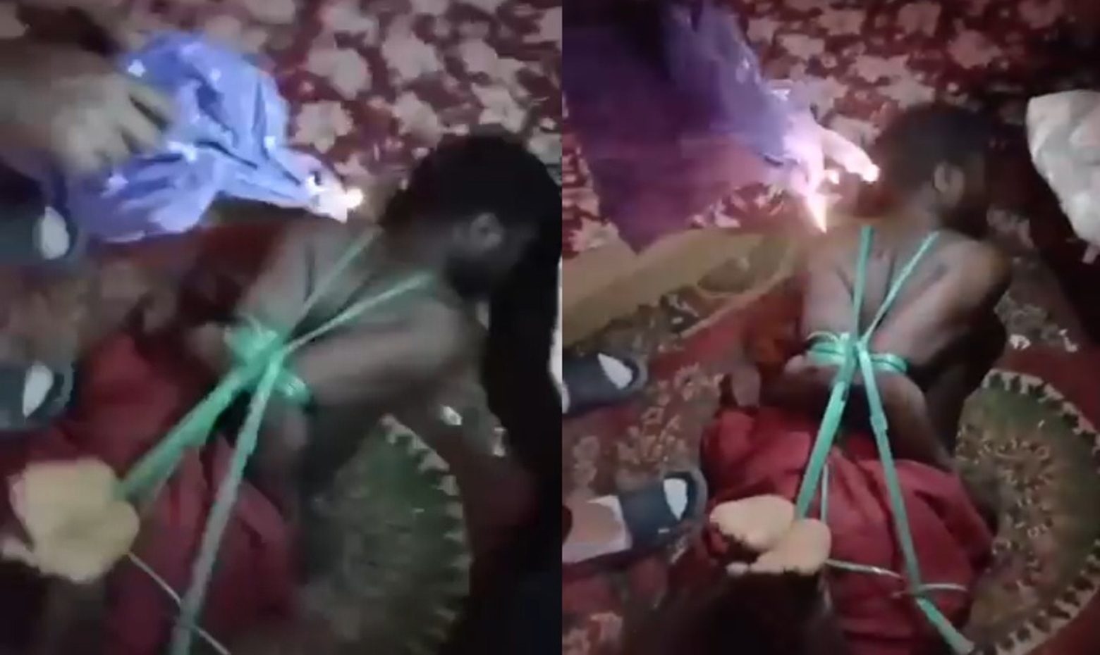 Man Brutally Beaten & Tortured with Melted Plastic by Heartless Human Smuggler