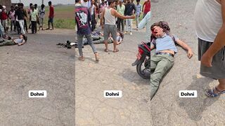 Head cratered in moto accident