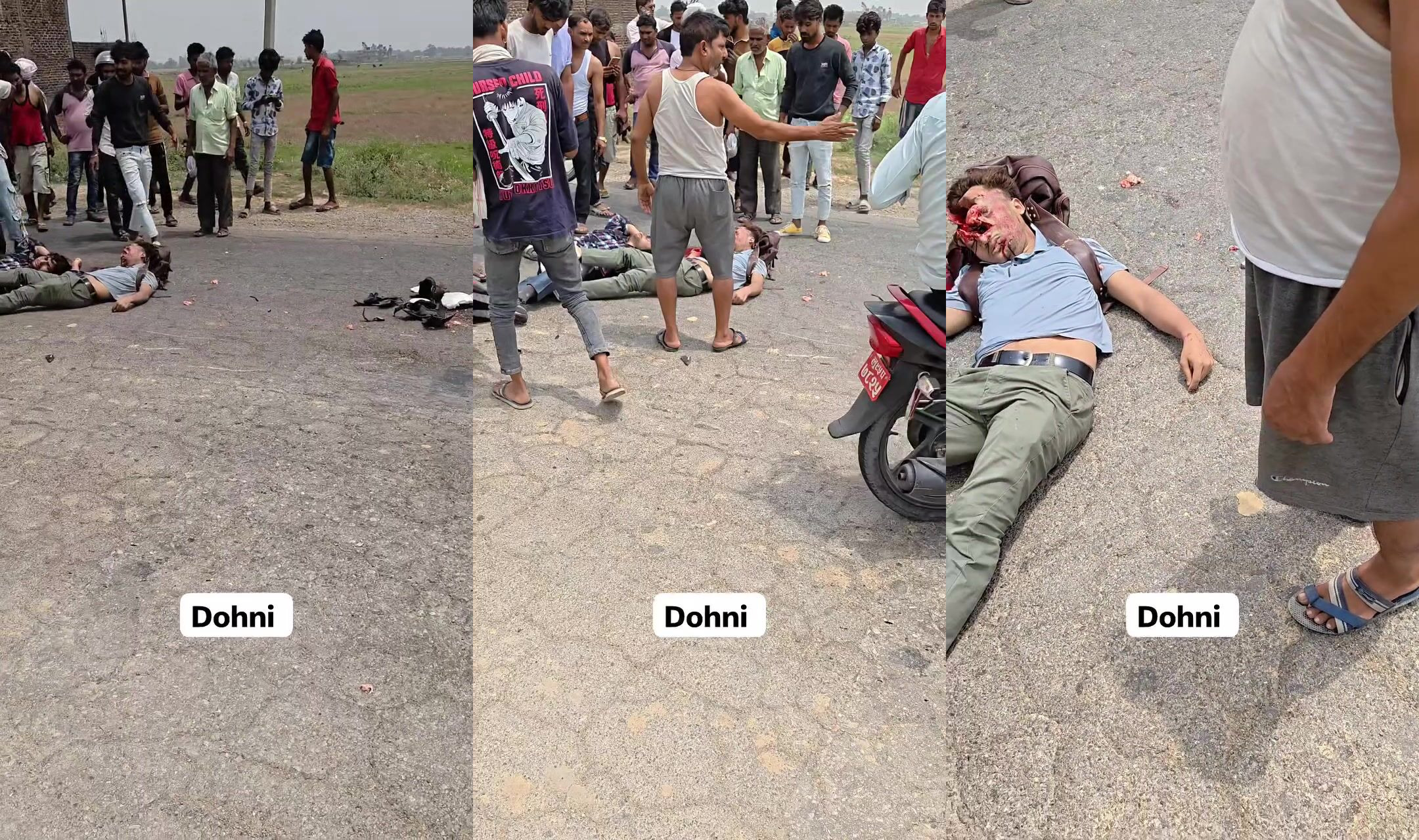 Head cratered in moto accident