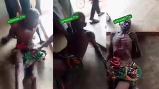 Farmer Shot In Stomach By Solders Got Guts Exposed