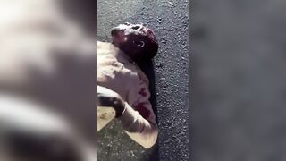 Innocent Woman Injured By Couple Of Fleeing On Motorcycle Thieves