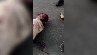 Innocent Woman Injured By Couple Of Fleeing On Motorcycle Thieves