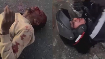 Innocent Woman Injured By Couple Of Fleeing On Motorcycle Thieves
