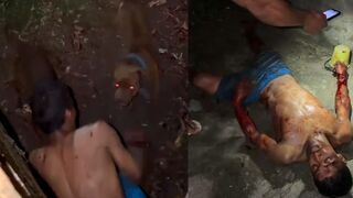 Homeowner's Pitbulls Attack Thief and Rip Both Arms to Shreds