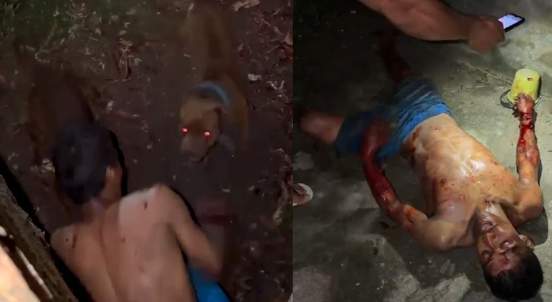 Homeowner's Pitbulls Attack Thief and Rip Both Arms to Shreds