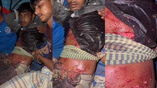 Adipose tissue on his belly after stabbed