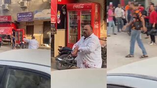 Mans hand almost severed beaten with sticks