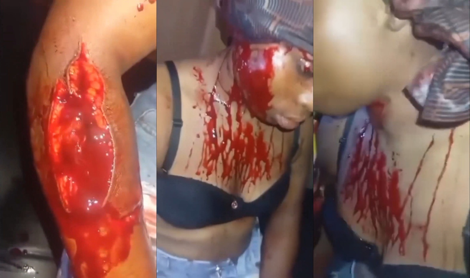 Married Woman Slashed Mercilessly by Machete-Wielding Girl