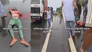 Man loses arm in road accident