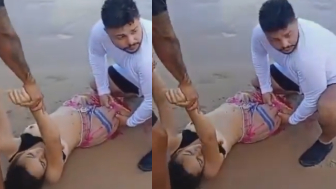19YO Woman Lost Leg Following Shark Attack In Brazil