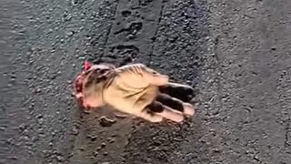 Driver Lost His Life and  Hand