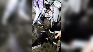 Driver Lost His Life and  Hand