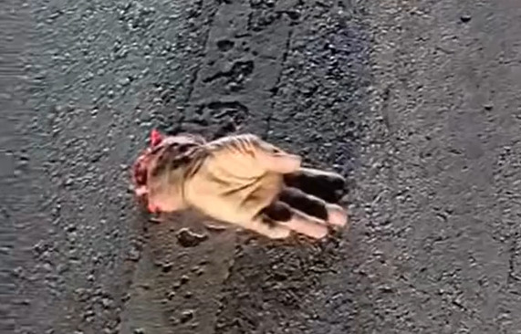 Driver Lost His Life and  Hand