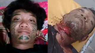 Man GotThroat Slit, Stabbed Multiple Times During Argument In Indonesia