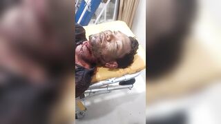Man Got Throat Slit, Stabbed Multiple Times During Argument In Indonesia