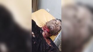 Man Got Throat Slit, Stabbed Multiple Times During Argument In Indonesia